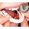 Snap On Smile Teeth Veneers Whitening Instant Cosmetic Dentistry Comfortable Veneer Cover Teeth Whitening Smile Denture