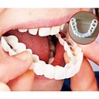 Snap On Smile Teeth Veneers Whitening Instant Cosmetic Dentistry Comfortable Veneer Cover Teeth Whitening Smile Denture