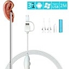 Visual Ear Spoon Ear Canal Endoscope Hd Visual Ear Spoon Cleaning Children